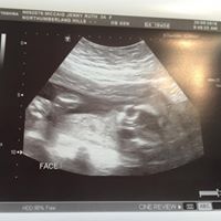 Northumberland Hills Hospital logo